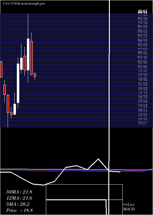  monthly chart TandemDiabetes